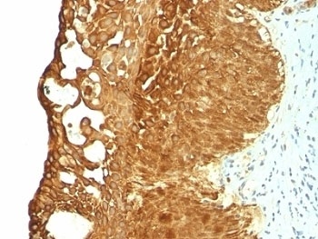 Cytokeratin 19 Antibody [KRT19/799]