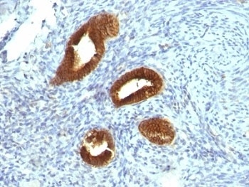 Cytokeratin 19 Antibody [KRT19/799]
