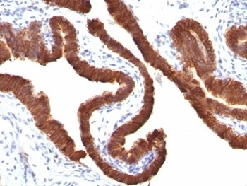 Cytokeratin 19 Antibody [KRT19/799]