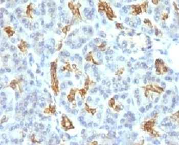 Cytokeratin 19 Antibody [KRT19/799]