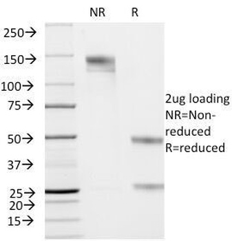 Cytokeratin 19 Antibody [KRT19/799]