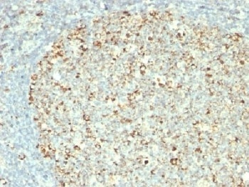 HSP60 Antibody [GROEL/730]