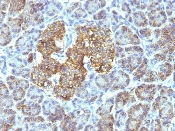 HSP60 Antibody [SPM253]