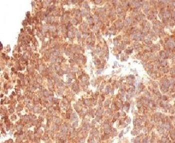 TOP1MT Antibody [TOP1MT/488]