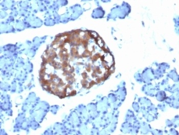 Chromogranin A Antibody [CHGA/798]
