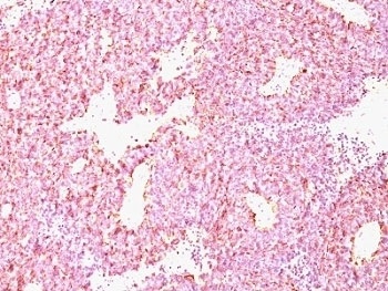 Chromogranin A Antibody [CHGA/798]