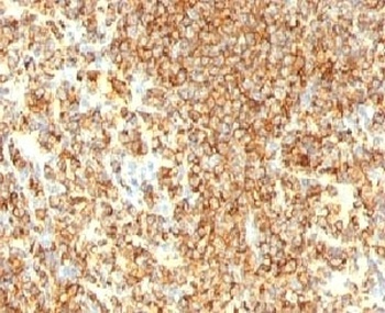 CD20 Antibody [IGEL/773]
