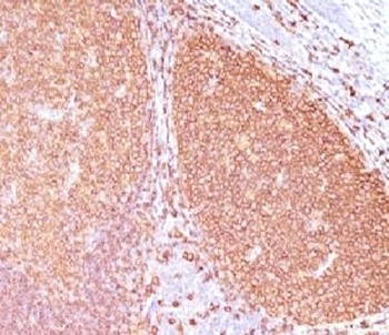 CD20 Antibody [IGEL/773]