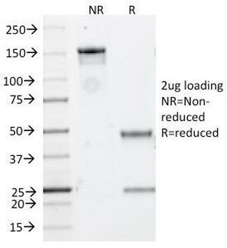 CD20 Antibody [IGEL/773]