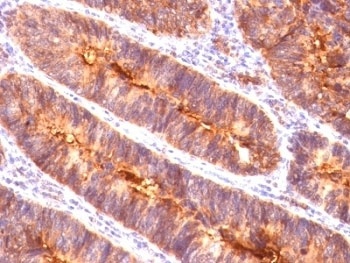 EMA Antibody [MUC1/520]