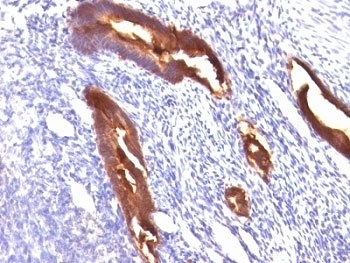 EMA Antibody [MUC1/520]