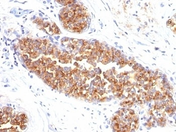 EMA Antibody [MUC1/520]
