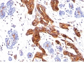 EMA Antibody [MUC1/520]