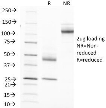 EMA Antibody [MUC1/520]