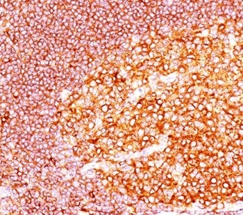 MALT1 Antibody [MT1/410]