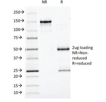 Bcl10 Antibody [BL10/411]