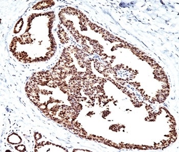 HSP60 Antibody [LK1]