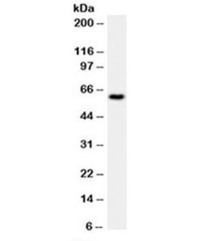 HSP60 Antibody [LK1]