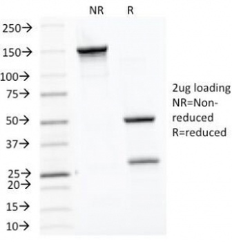 HSP60 Antibody [LK1]