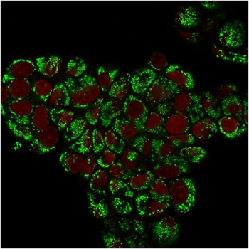 HSP60 Antibody [LK1]