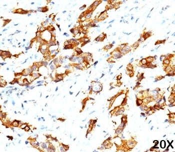 HSP27 Antibody [G3.1]