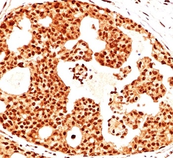 Estrogen Receptor beta Antibody [ERb455]