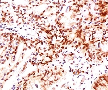 Estrogen Receptor beta Antibody [ERb455]