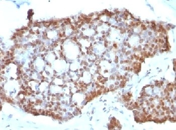Estrogen Receptor beta Antibody [ERb455]