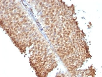 Estrogen Receptor beta Antibody [ERb455]
