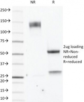 Estrogen Receptor beta Antibody [ERb455]