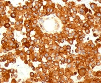 CD63 Antibody [MX-49.129.5]