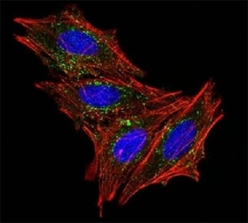 CD63 Antibody [MX-49.129.5]