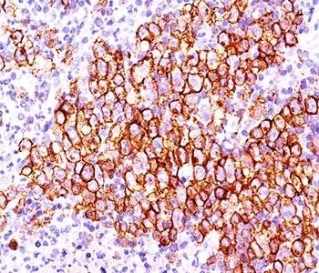 CD30 Antibody [CD30/412]
