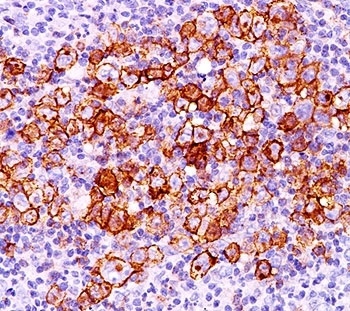 CD30 Antibody [CD30/412]