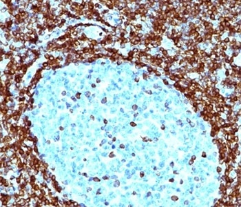 Bcl-2 Antibody [124]
