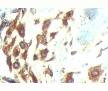 ATF6 Antibody [AF6229]