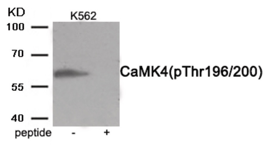CaMK4 (phospho Thr196/200) Antibody