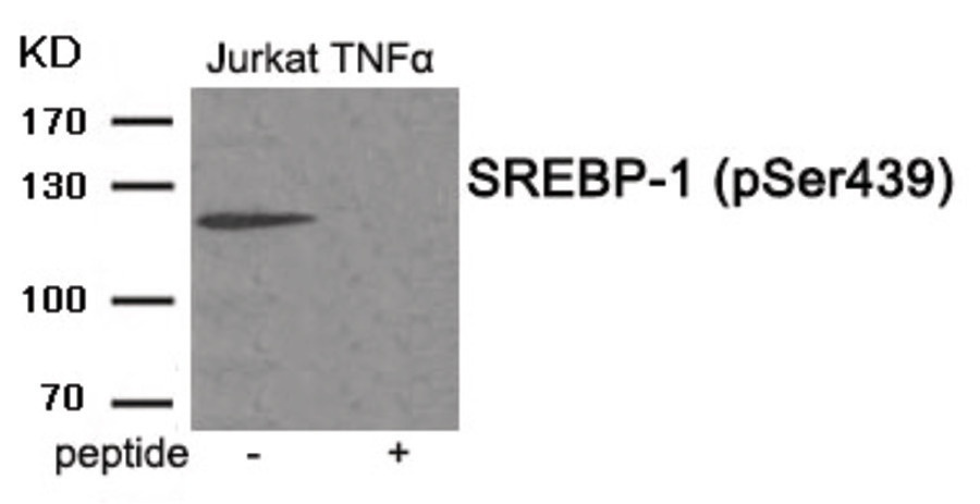 SREBP-1 (phospho Ser439) Antibody