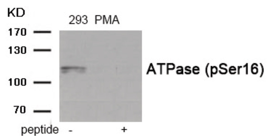 ATPase (phospho Ser16) Antibody
