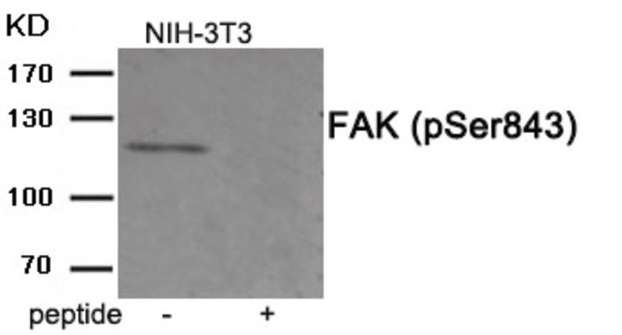 FAK (phospho Ser843) Antibody