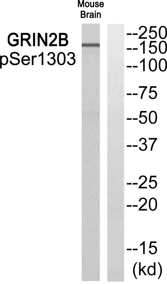 GRIN2B (phospho Ser1303) Antibody