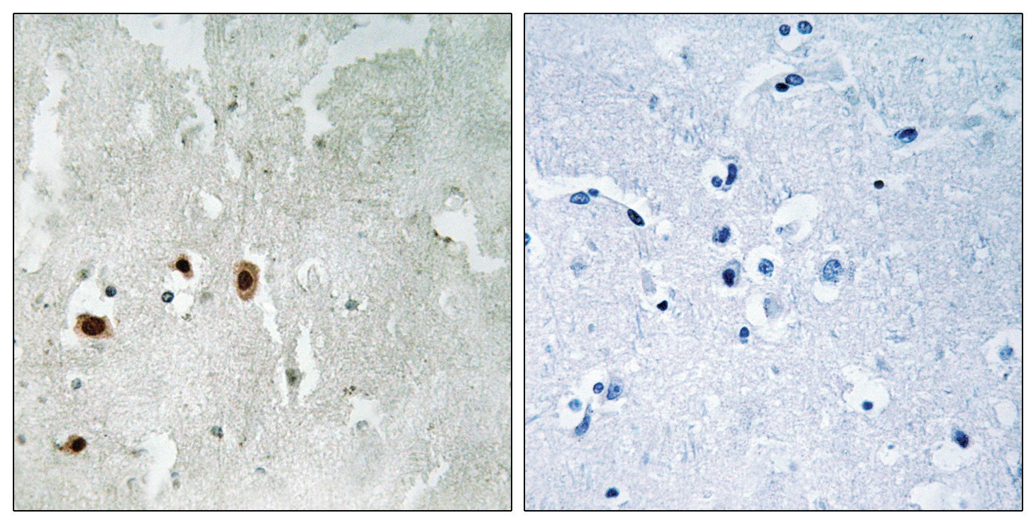 Tip60 (phospho Ser90) Antibody