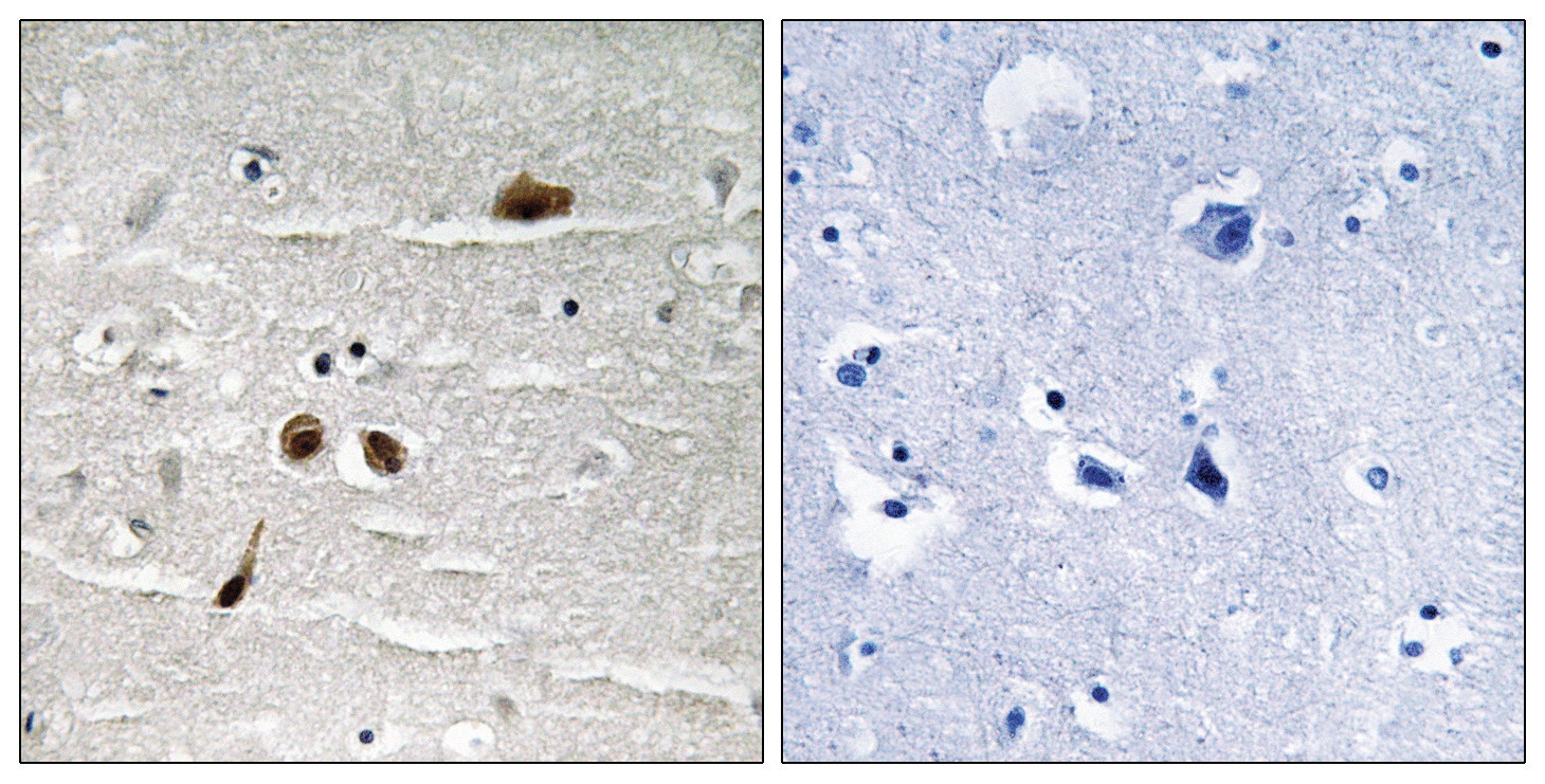 MDC1 (phospho Ser513) Antibody