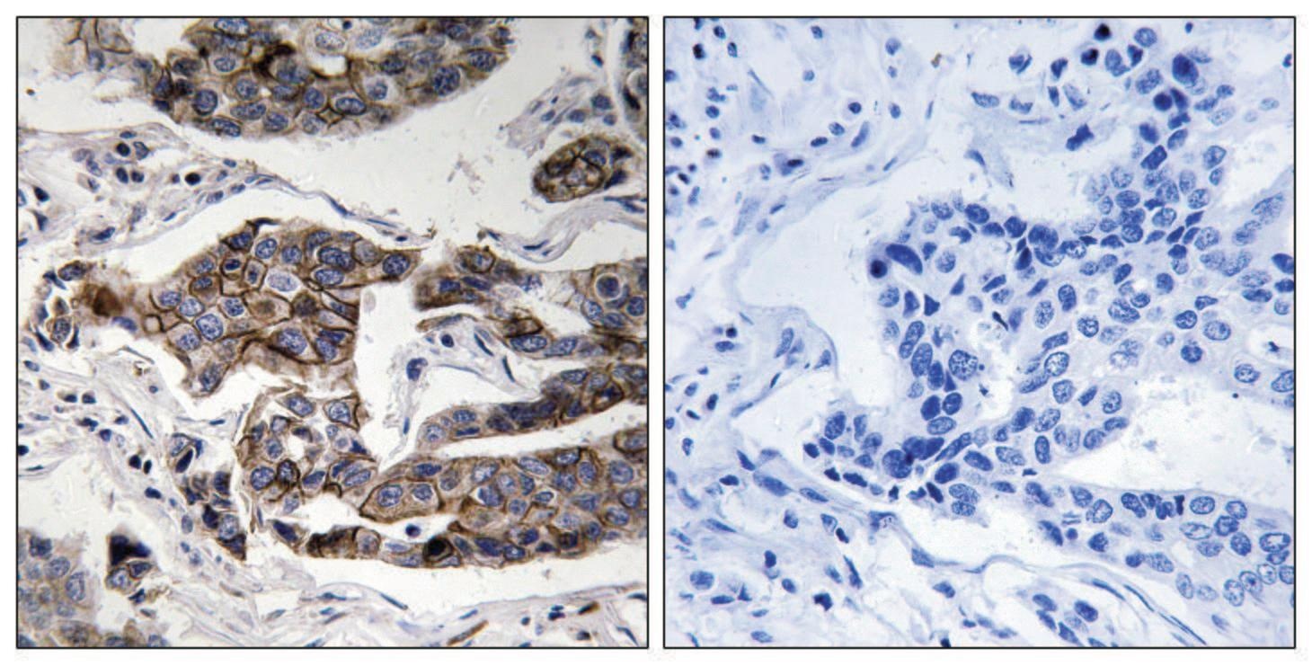 Girdin (phospho Ser1417) Antibody