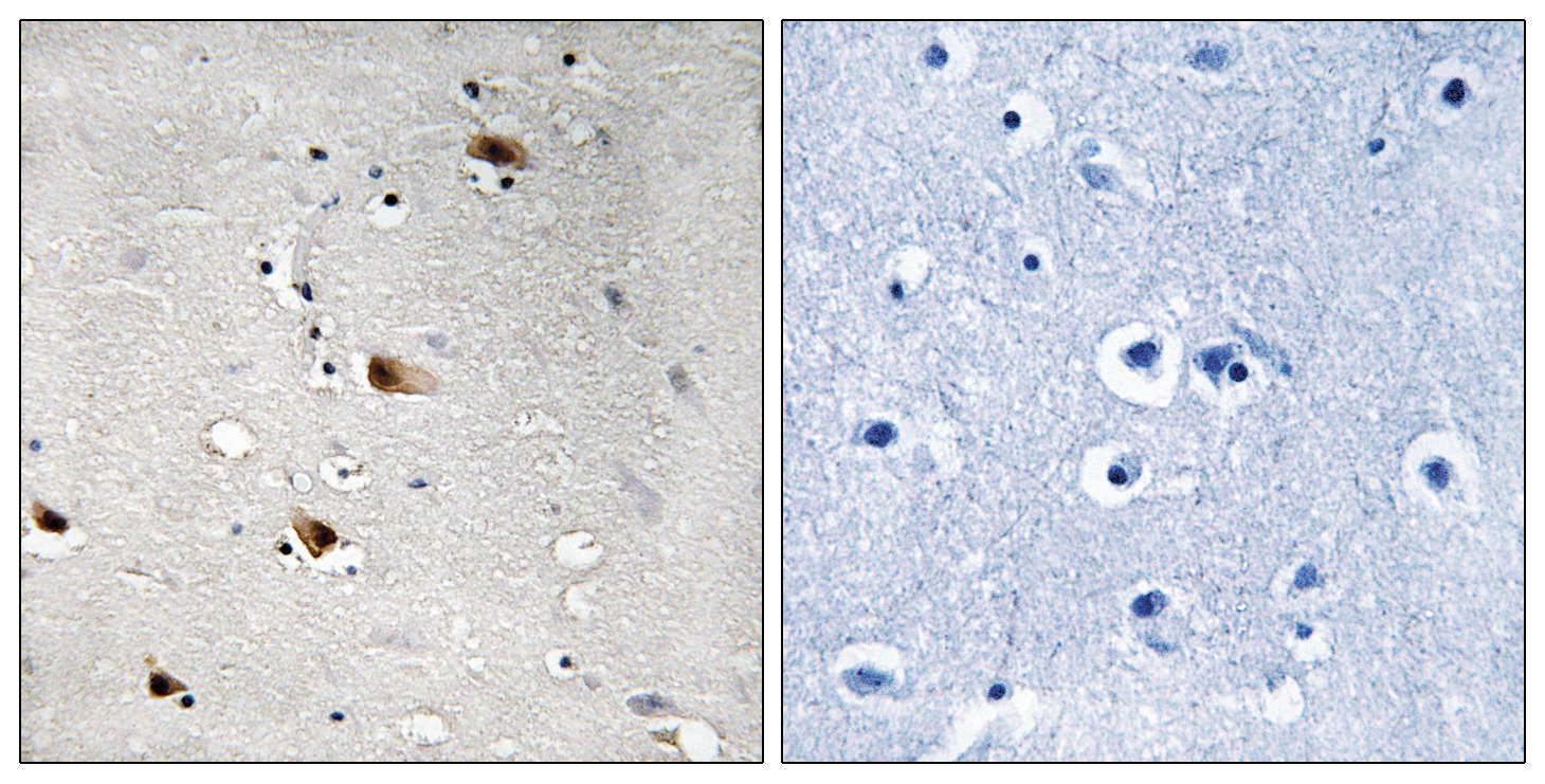 E2A (phospho Thr355) Antibody