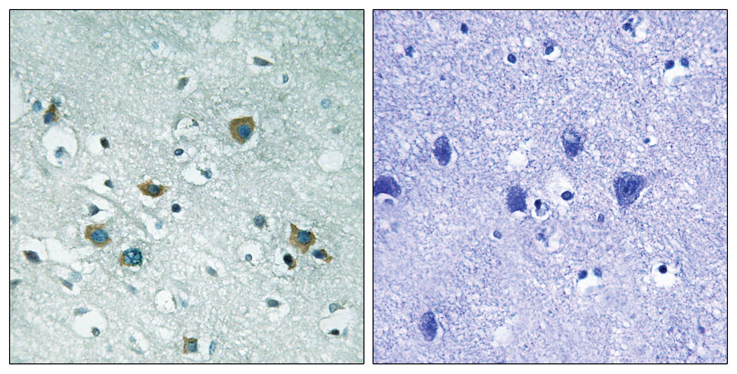 CRMP-2 (phospho Thr509) Antibody