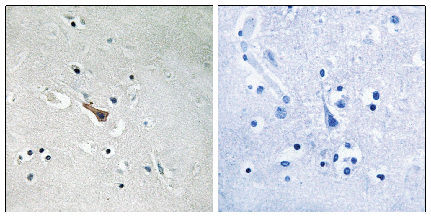 APLP2 (phospho Tyr755) Antibody