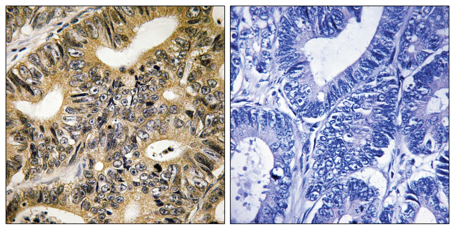 4E-BP1 (phospho Thr70) Antibody
