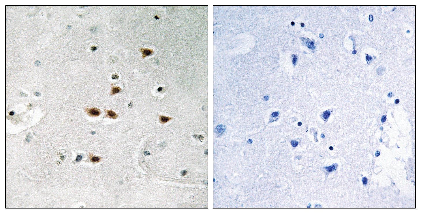 ITCH (phospho Tyr420) Antibody