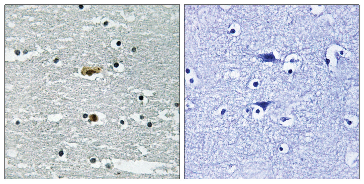STK39 (phospho Ser309) Antibody